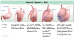 Bloat on sale prevention surgery